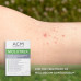 Acm molutrex 5% potassium hydroxide solution – 3ml